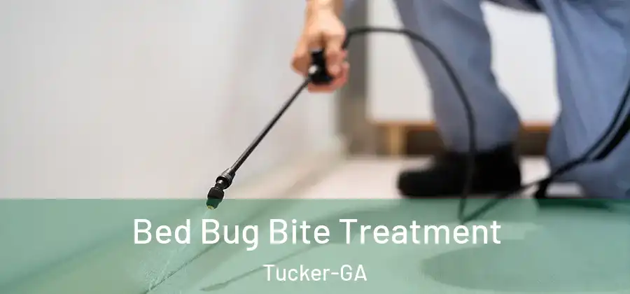 Bed Bug Bite Treatment Tucker-GA